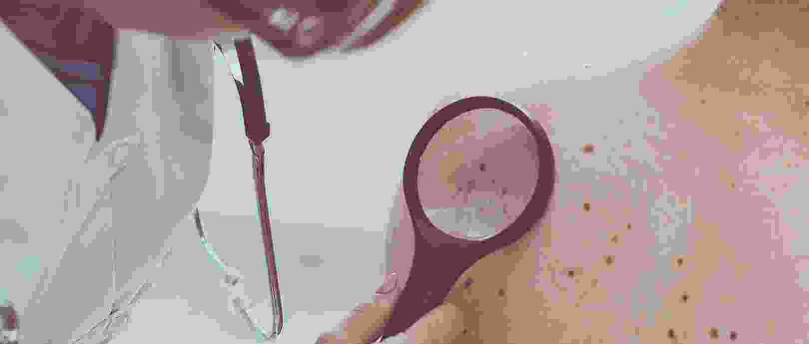 Regular skin check-ups with your dermatologist